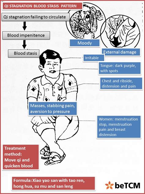 qi blood stagnation examples